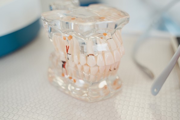 emergency dental implants